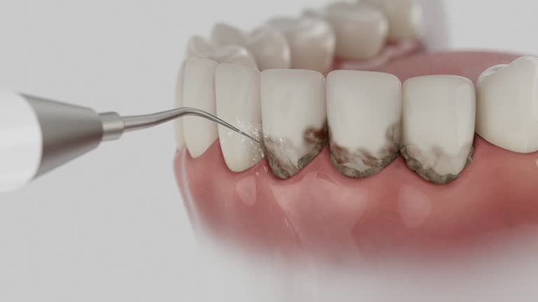 Trusted Root Canal Treatment service in Claiborne, LA - Dentist Open Now